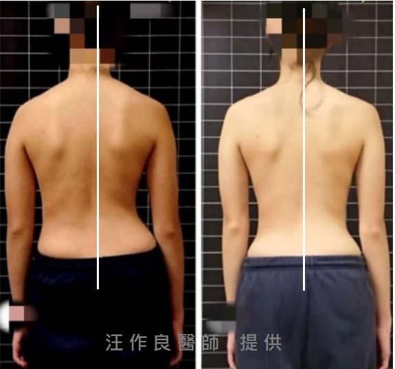 測移示意