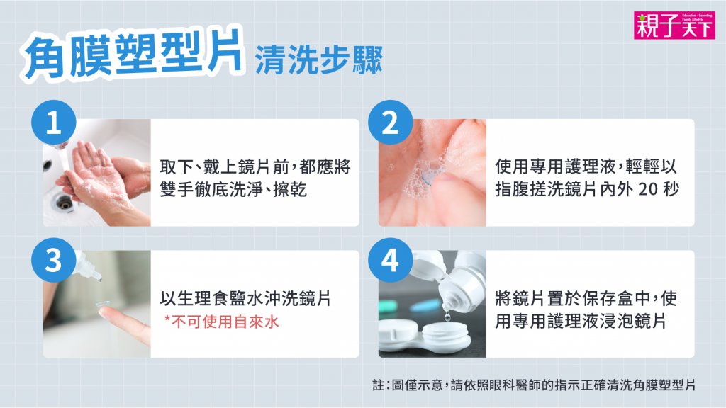 角膜塑型片-角膜塑型片價格-角膜塑型片後遺症-角膜塑型片清洗