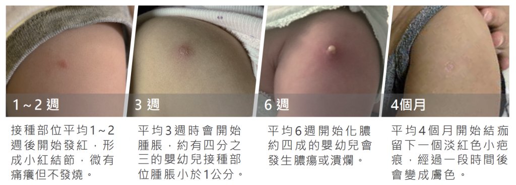 圖／《卡介苗接種敬告家長書》